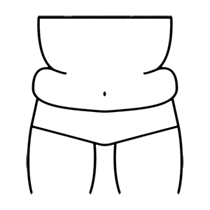 تجميل