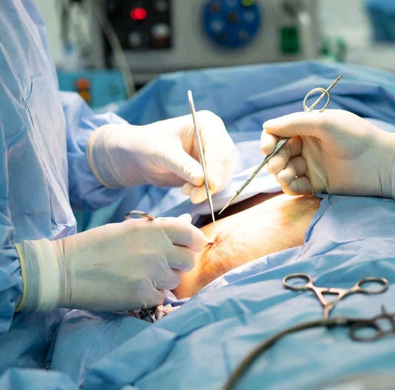 إعادة بناء الثدي