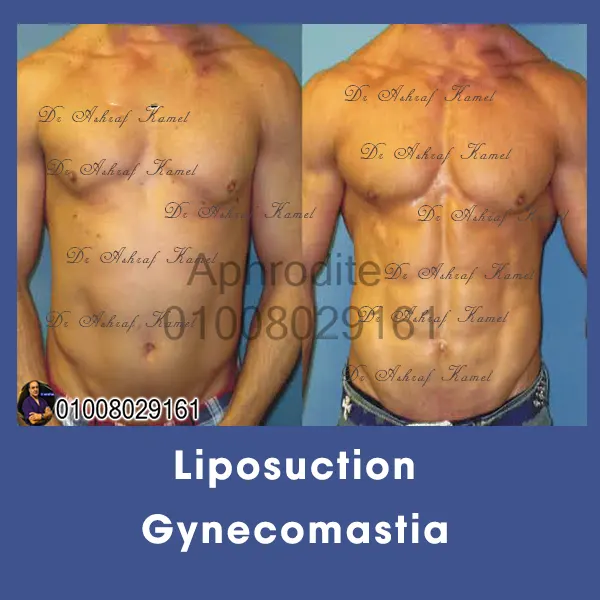 نحت عضلات البطن 6 باكس