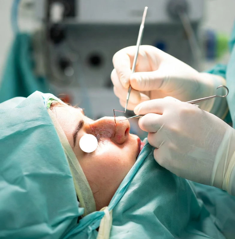 تجميل الأنف